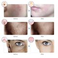 7-Color LED Photon Therapy Rechargeable Facial Mask - Skin Rejuvenation & Beauty Device